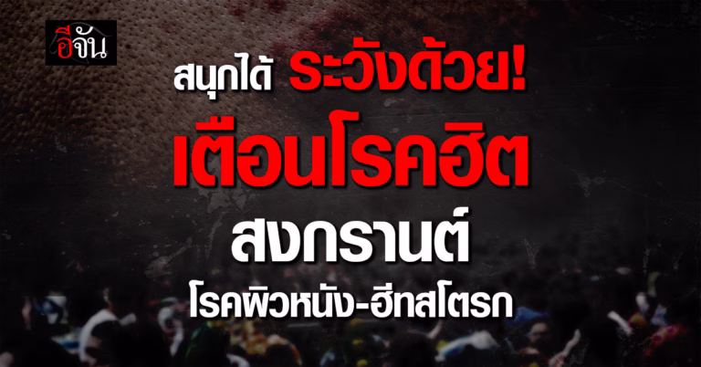 .แพทย์ มช. เตือนช่วงสงกรานต์ ระวังโรคผิวหนัง-ฮีทสโตรก.