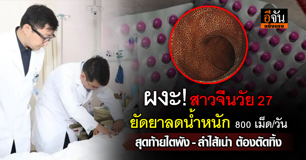 อุทาหรณ์! สาวจีนกินยาระบายหวังลด นน. ซัดเข้าปากวันละ 800 เม็ด สุดท้ายเกือบไม่รอด