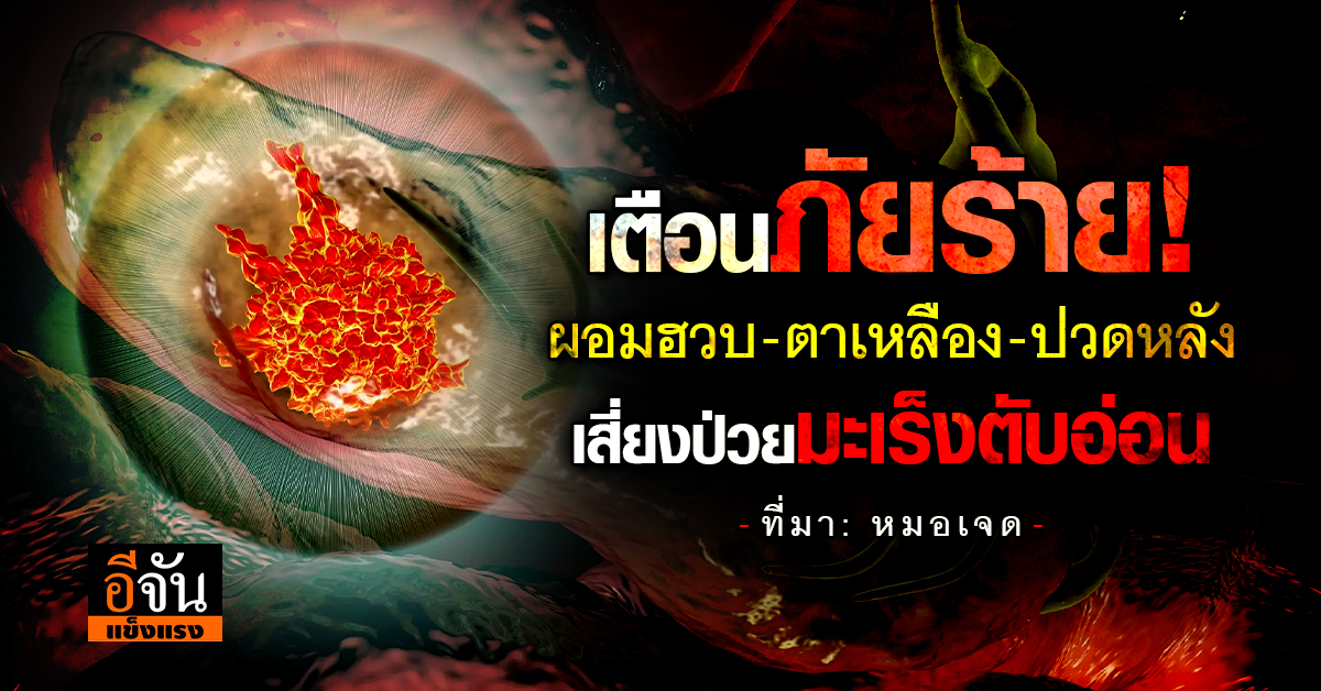 อึลอย-เหม็นเน่า! สัญญาณตับอ่อนพัง มะเร็งร้ายโจมตีไม่ทันตั้งต