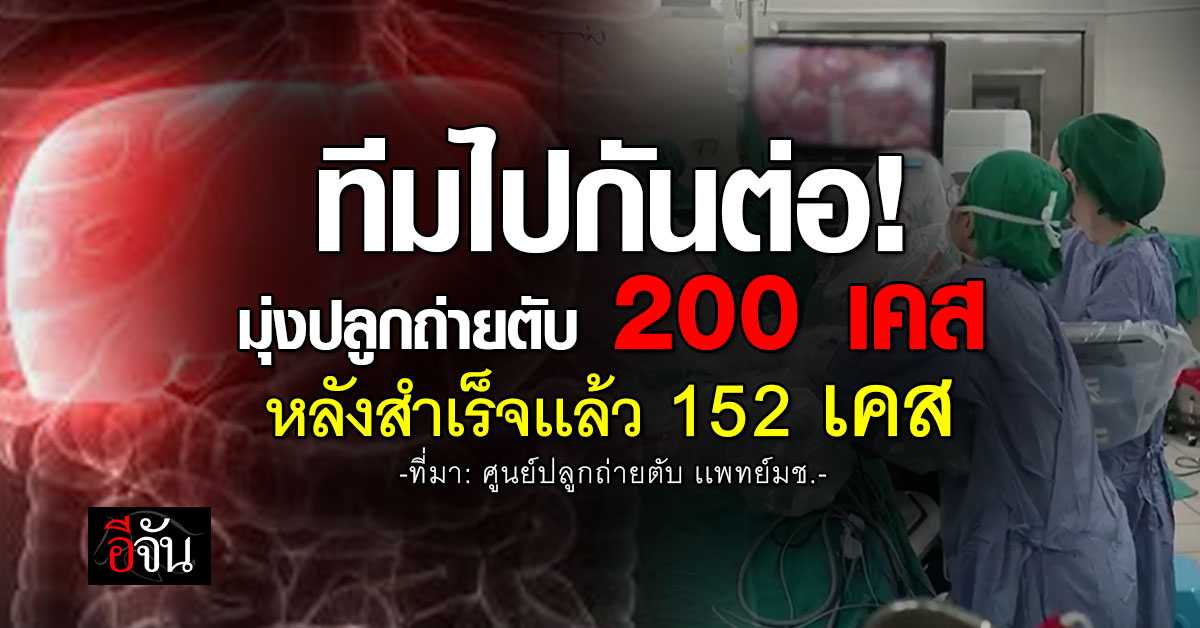 ไปกันต่อ! ศูนย์ปลูกถ่ายตับ มช. มุ่งทำต่อหลังสำเร็จเเล้ว 152 