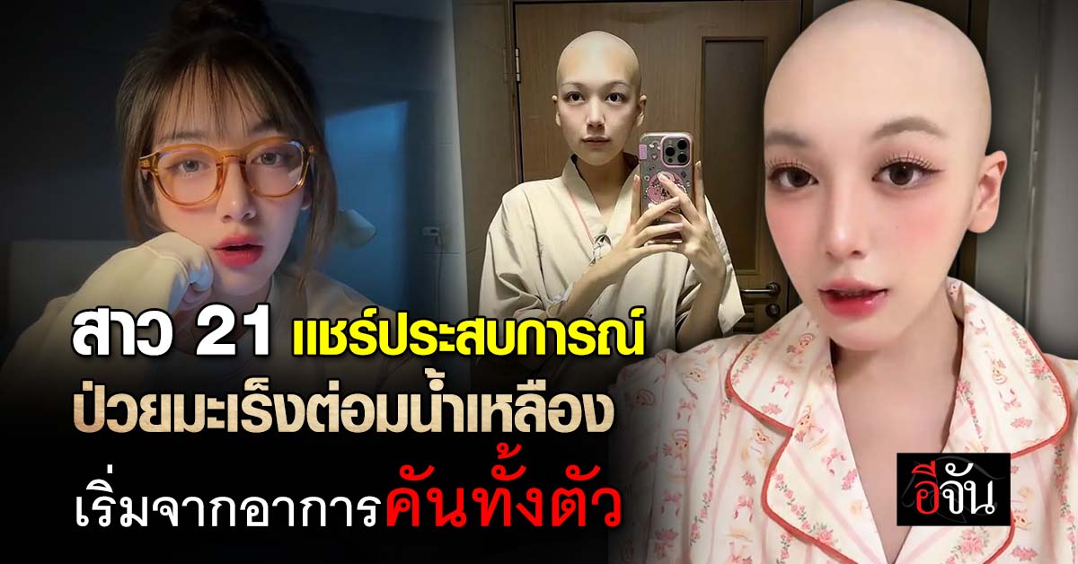 สาว 21 แชร์ประสบการณ์ ป่วยมะเร็งต่อมน้ำเหลือง