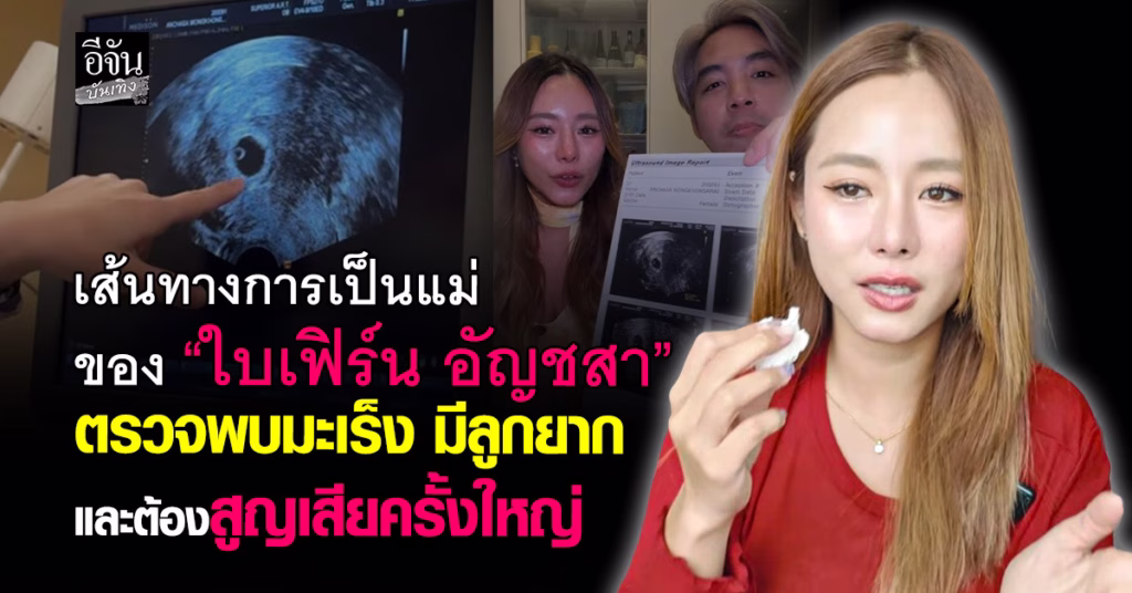 ใบเฟิร์น อัญชสา